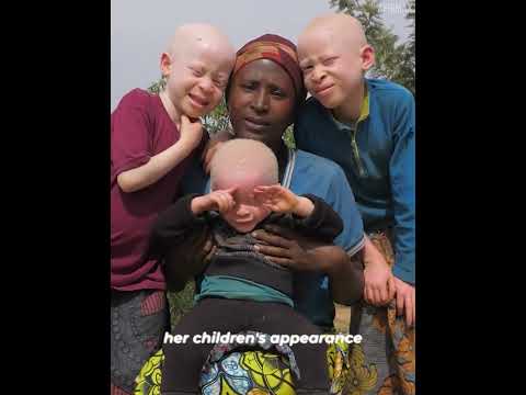 A Mother's Love for Her Albino Kids