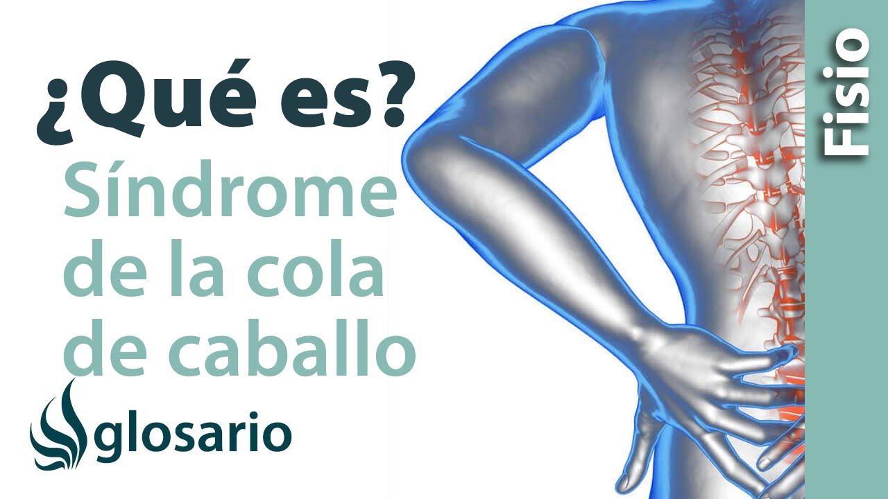 Watch SÍNDROME DE LA COLA DE CABALLO | ¿Qué es Now SÍNDROME DE LA COLA DE CABALLO | ¿Qué es