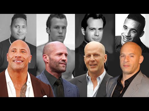 "Just Go Bald Because The Rock, Bruce Willis & Jason Statham Are Attractive"