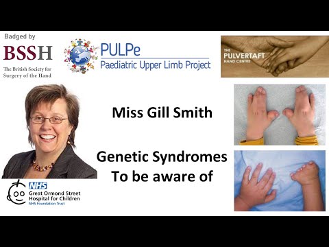 Genetic syndromes to be aware of by Miss Gill Smith