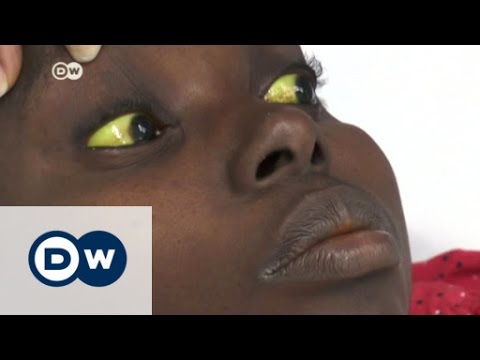 Yellow fever epidemic spreads in Angola | DW News