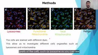 Testing iLCT-evaluated compounds in patient-derived neurons - Dr Francesco Capriglia