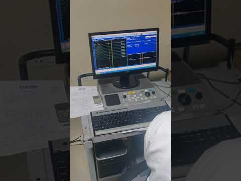 Nerve conduction study