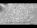 LISTERIA monocytogenes tumbling motility - YouTube
