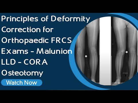 Principles of Deformity Correction for Orthopaedic Exams