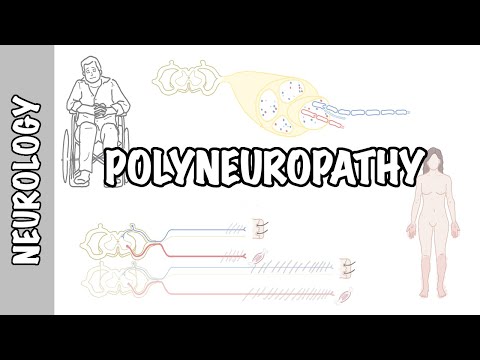 Approach to Polyneuropathy - causes, pathophysiology, investigations