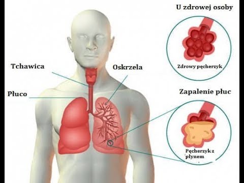Ćwiczenia z powrotem ból wzmocnienie mięśni Mięśnie strain hemoroidy
