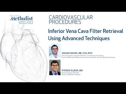 Inferior Vena Cava Filter Retrieval Using Advanced Techniques