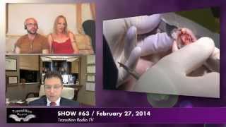 Facial feminization surgery (FFS) in Florida