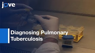 Diagnosing Pulmonary Tuberculosis with the Xpert MTB/RIF Test