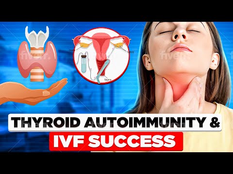 Subclinical hypothyroidism IVF Infertility miscarriage