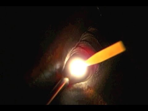 Tig welding stainless steel - weird tip to help distortion