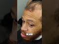 Was This Haircut Worth What He Paid Slyhuncho Aura Transformation