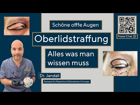 Upper eyelid lift & eyebrow lift: This is what eyelid surgery really works like! 👁✨