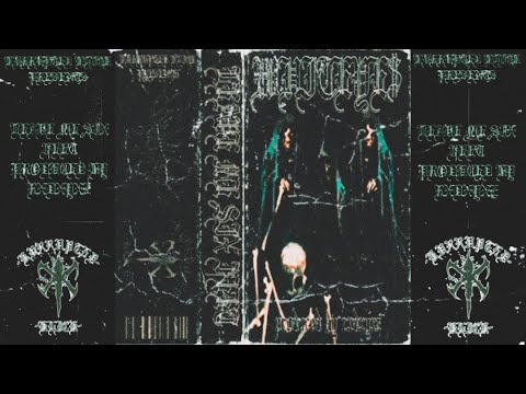 WHITEYE$ - LEAVE ME SIX FEET [ Prod. RXDXYXZ ]