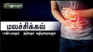 Doctor On Call 12-04-2022 PuthuYugam tv Show