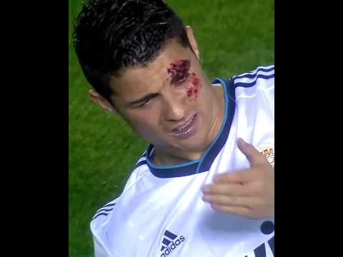 When Players Get Hurt + Ronaldo 🤯