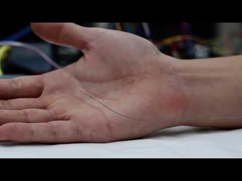 Demonstration of a Coaxially Aligned, Robotically Steerable Guidewire (8451)