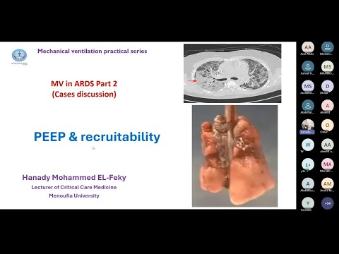 ARDS Part 2 Lecture (Peep & Recruitment) 20251226