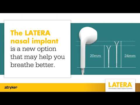 The LATERA nasal implant is a new option that may help you breathe better