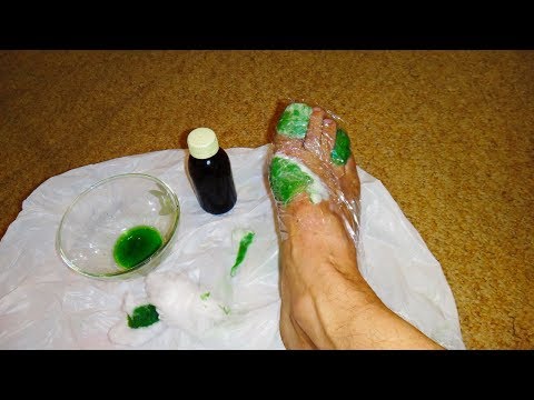 Nach gribka damit wuchs den Nagel Das Mittel von gribka bei der Reparatur der Wohnungen
