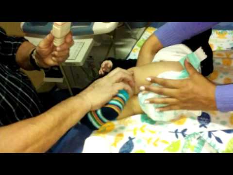 Capacitación para comentarios osteocondrosis Lado superior dolor en el cuello