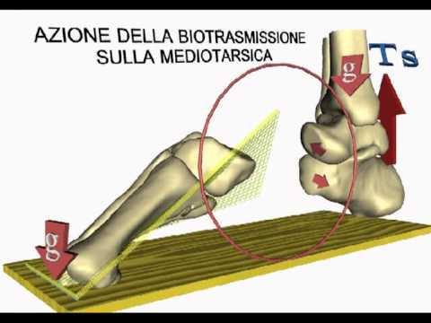Brace incernierato sul ginocchio figli avuti in comune Dolore alla schiena aumentando tirando