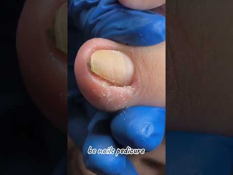 Cute nails satisfying pedicure #nails #satisfying #pedicure
