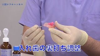 入れ歯の汚れ方でわかる口腔機能の問題点