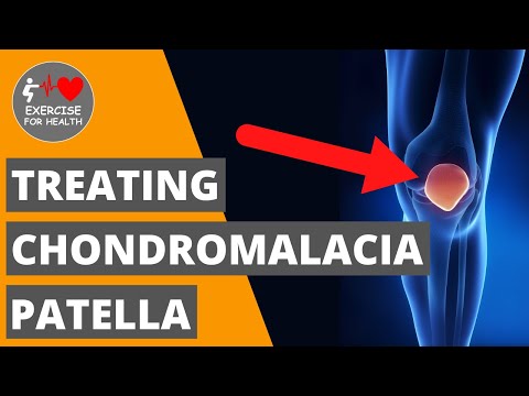 Exercises to treat runners’ knee (Patellofemoral Pain Syndrome)