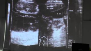 18) Dr.Hussein Khairy 15-1-15 (UltraSound)