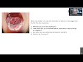 ENT Cases Delivered By Professor Ram Dhillon