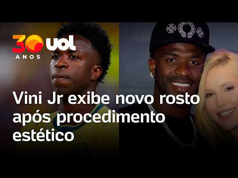 Vini Jr. exibe novo rosto após fazer ‘naturalização facial’ com o mesmo médico de Virginia Fonseca