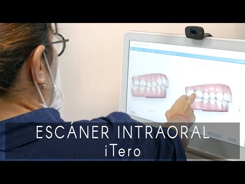 Escáner intraoral iTero