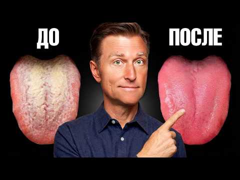 Как избавиться от кандиды за 24 часа?🔥