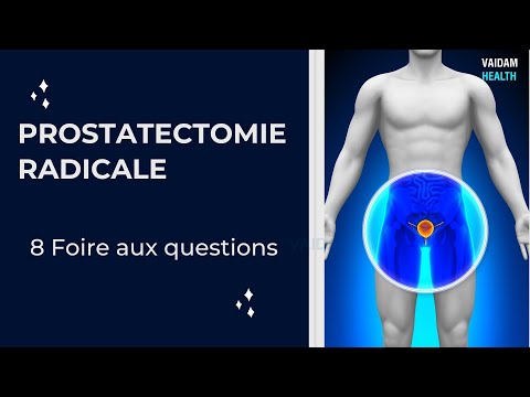 PROSTATECTOMIE RADICALE