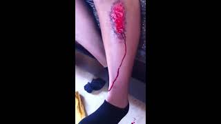 Tissue Scab (ripped off)