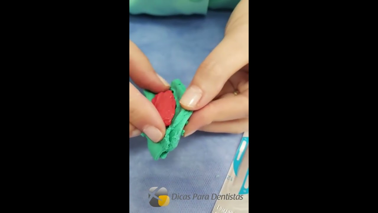 Restauração Posterior Semi Direta - Live Instagram