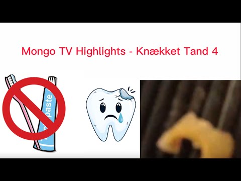 Mongo TV Highlights - Knækket Tand 4