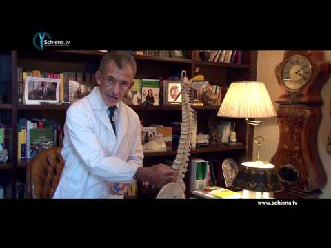 Osteocondrosi delle principali sindromi Compresse con osteoartrosi del ginocchio