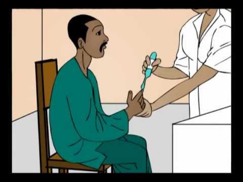 comment soigner un ictus