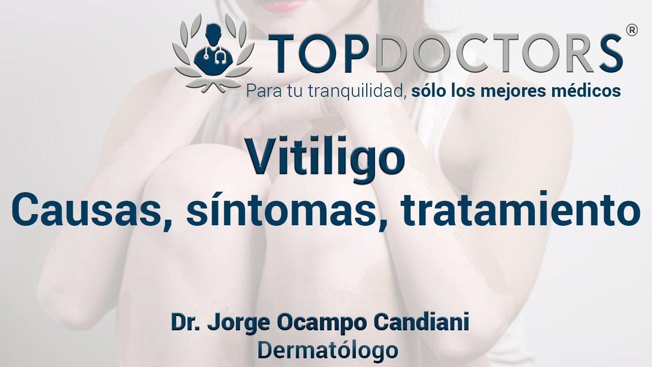 ¿Qué es vitiligo causas, síntomas y tratamiento