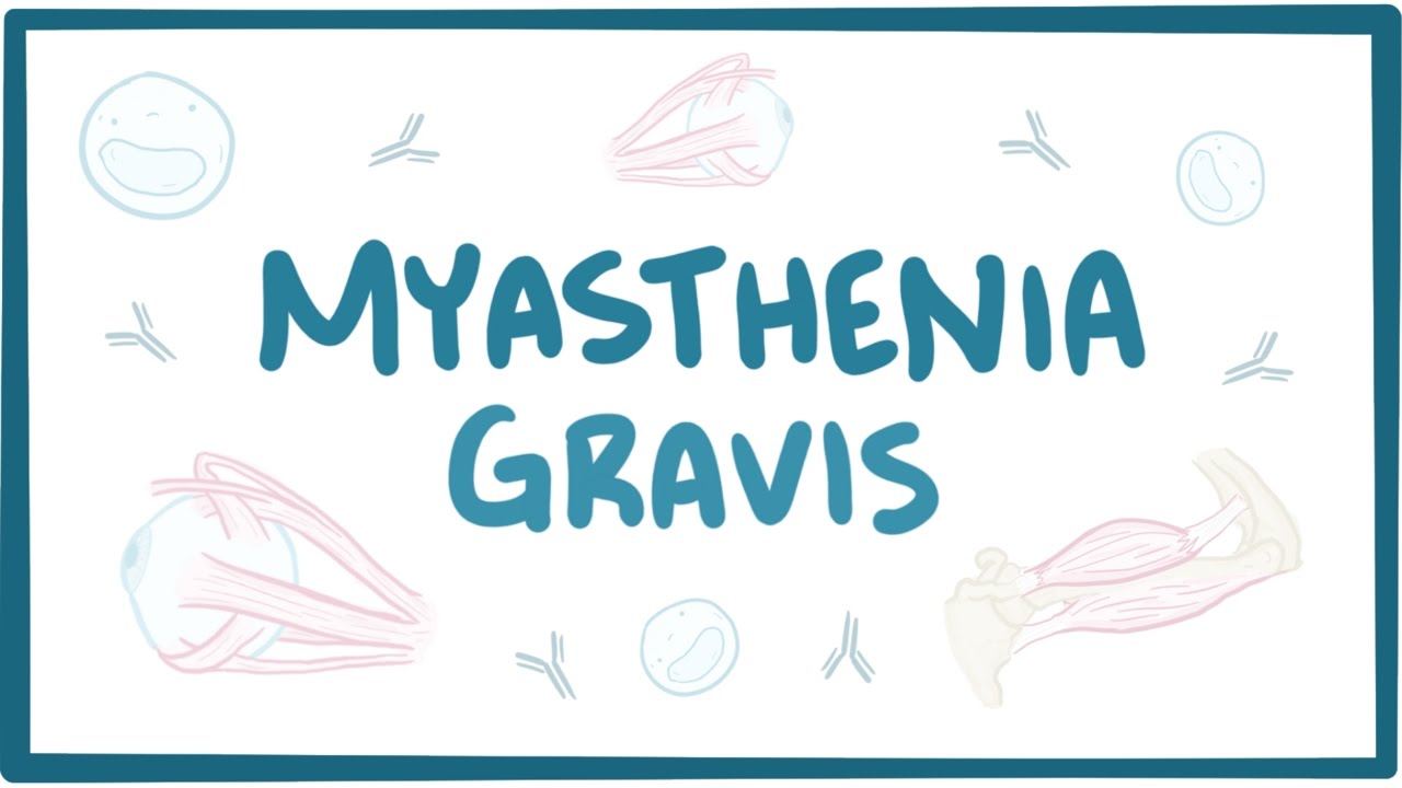 Myasthenia gravis - causes, symptoms, treatment, pathology