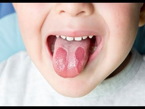 Shihni me kujdes gjuhën tuaj për të kuptuar a jeni të shëndetshëm