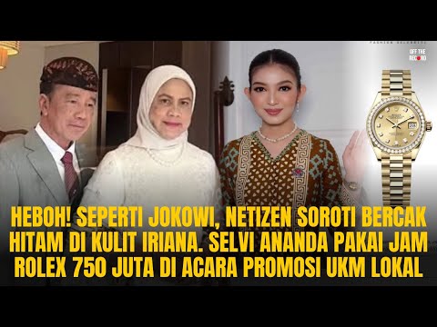 HEBOH! KULIT IRIANA MENGHITAM & KAKI BENGKAK! NETIZEN: PERMAISURI KETULARAN RAJA JAWA?! | OTR #1063
