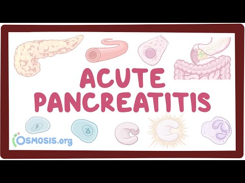 Acute pancreatitis - causes, symptoms, diagnosis, treatment, pathology Video
