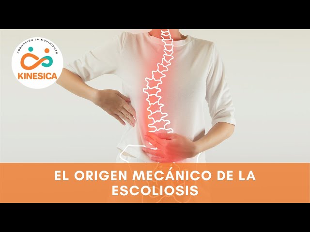 Vídeo relacionado con TEORÍA Y BIOMECÁNICA DE LA ESCOLIOSIS: ESCOLIOSIS & ENTRENAMIENTO