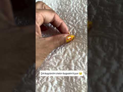Sansa ne olmuş kedi dişi gördünüz mü