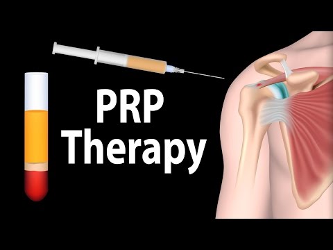 PRP Therapy