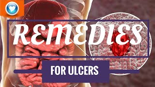 10 Science Backed Home Remedies for Ulcers
